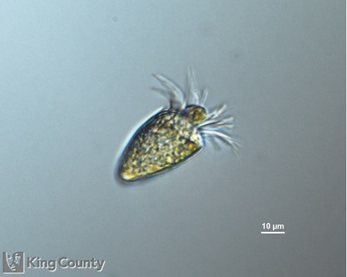 Photo of Strombidium